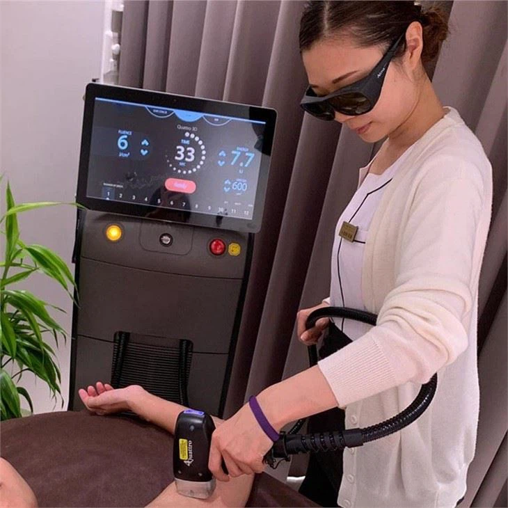 Soprano Ice Laser Hair Removal