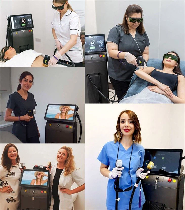 Soprano Laser Hair Removal
