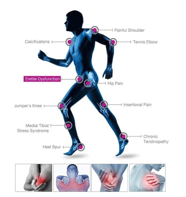 Professional Shockwave Machine For Pain Relief, Muscle Recovery & Body Therapy manufacturers