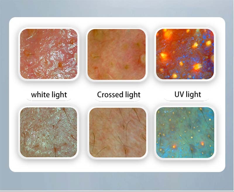 Skin & Hair Analysis Machine 2026 New Upgrade best