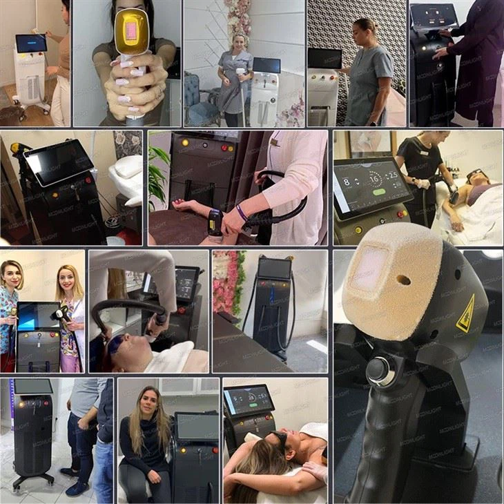 The Best Laser Hair Removal Machines in Europe